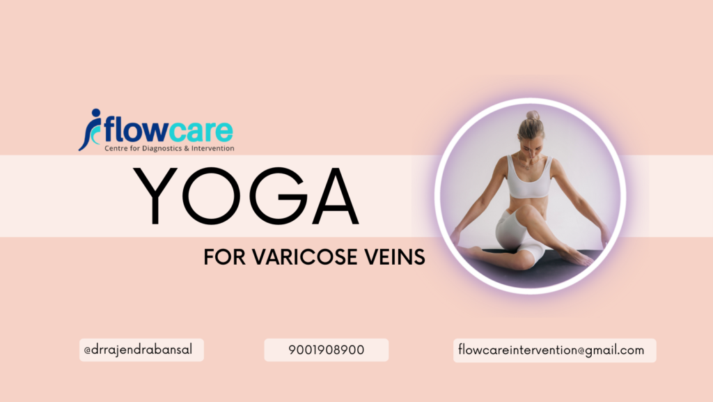 yoga-for-varicose-veins