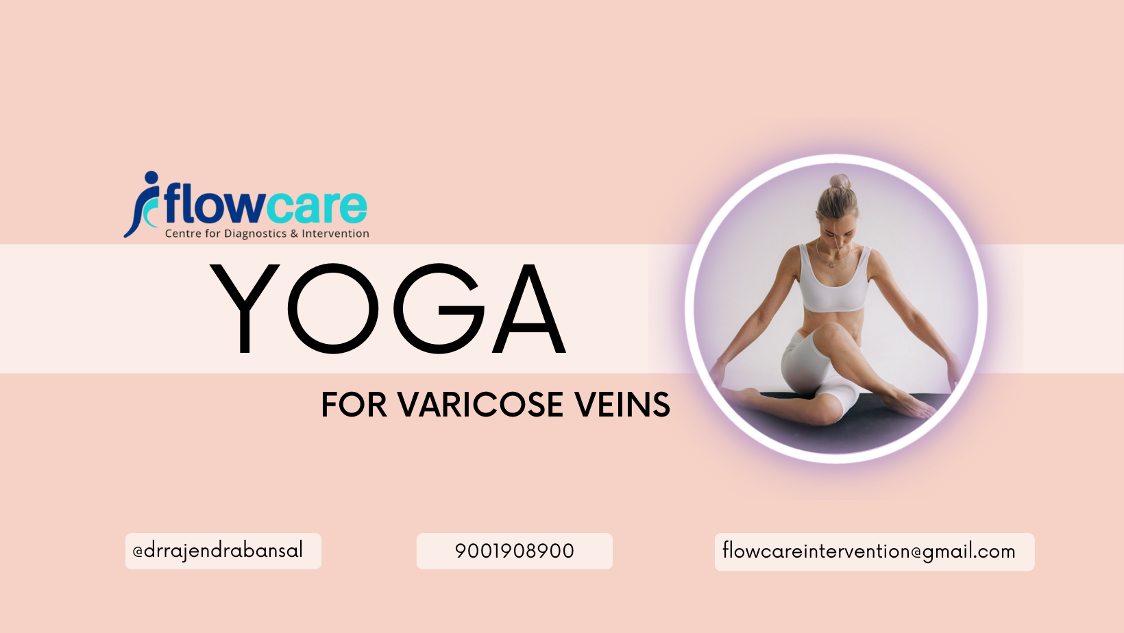 yoga-for-varicose-veins