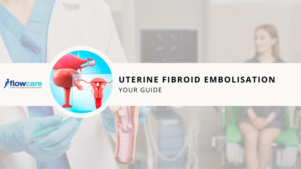 Uterine-Fibroid