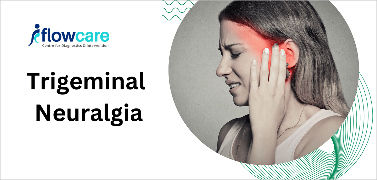Trigeminal Neuralgia