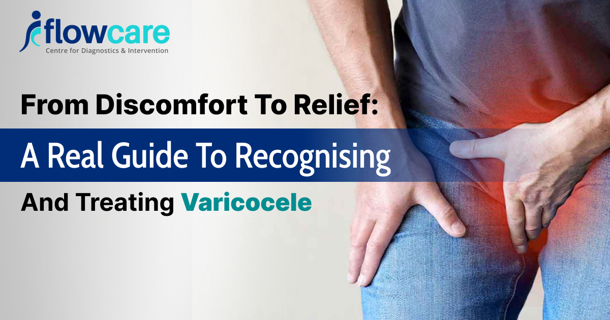 treating varicocele